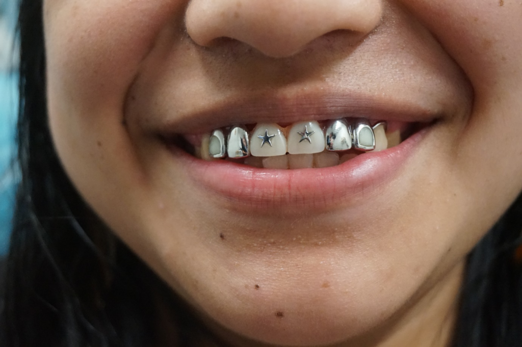A client’s teeth before getting dental treatment.