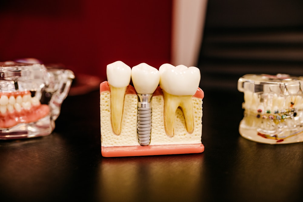 A dental implant model